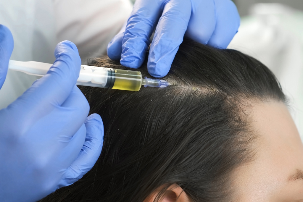 Плазмолифтинг (плазмотерапия) для волос